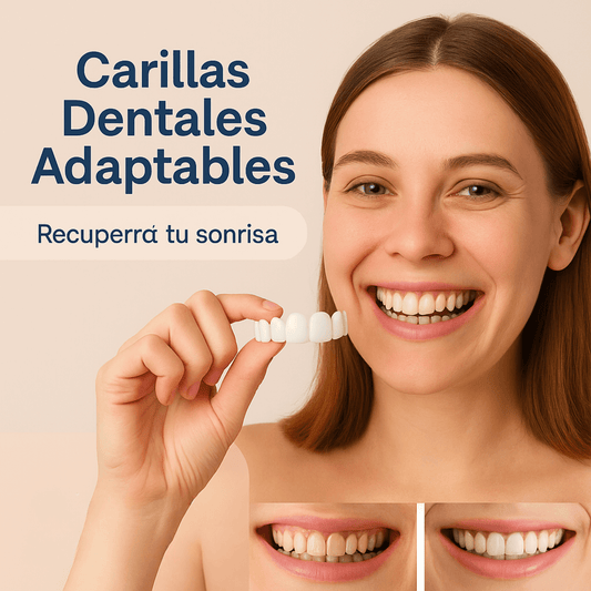 Carillas dentales Snap on Smile - Sonrisa perfecta en segundos