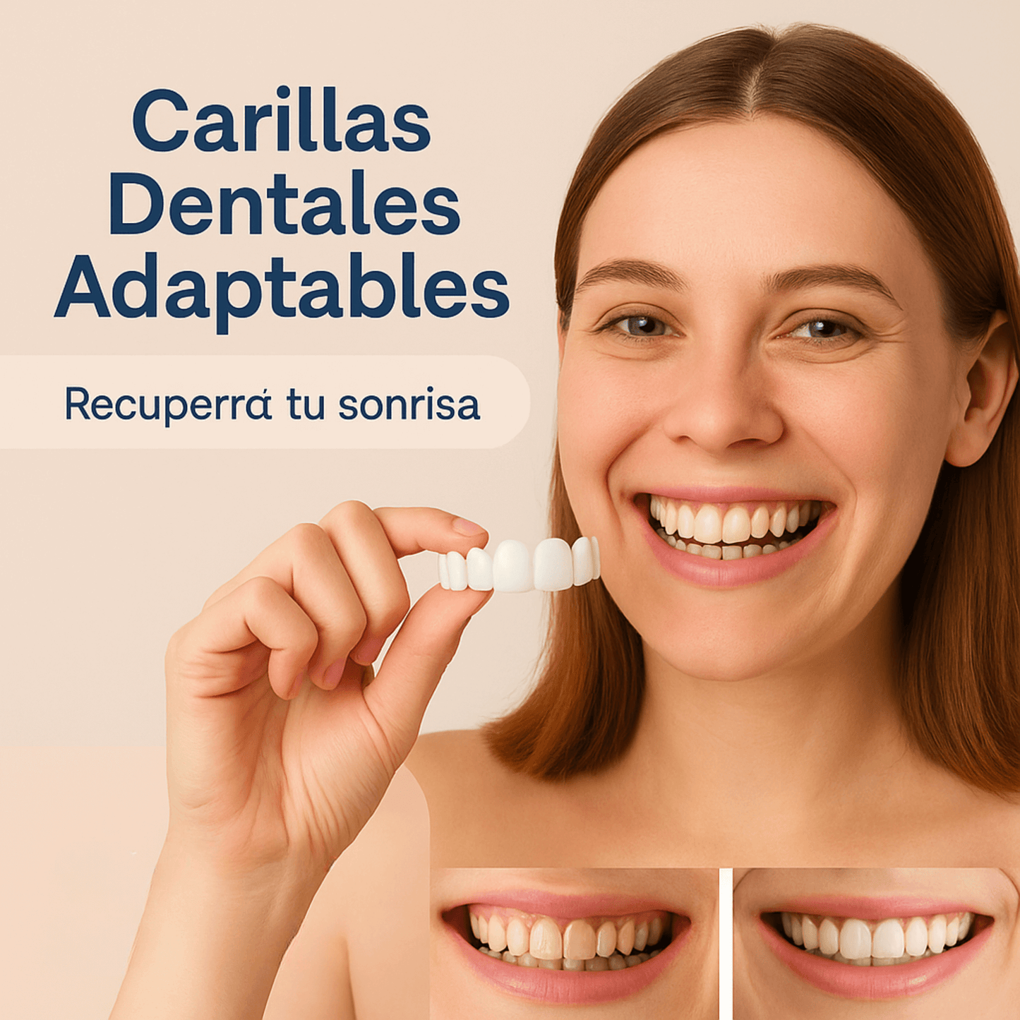 Carillas dentales Snap on Smile - Sonrisa perfecta en segundos