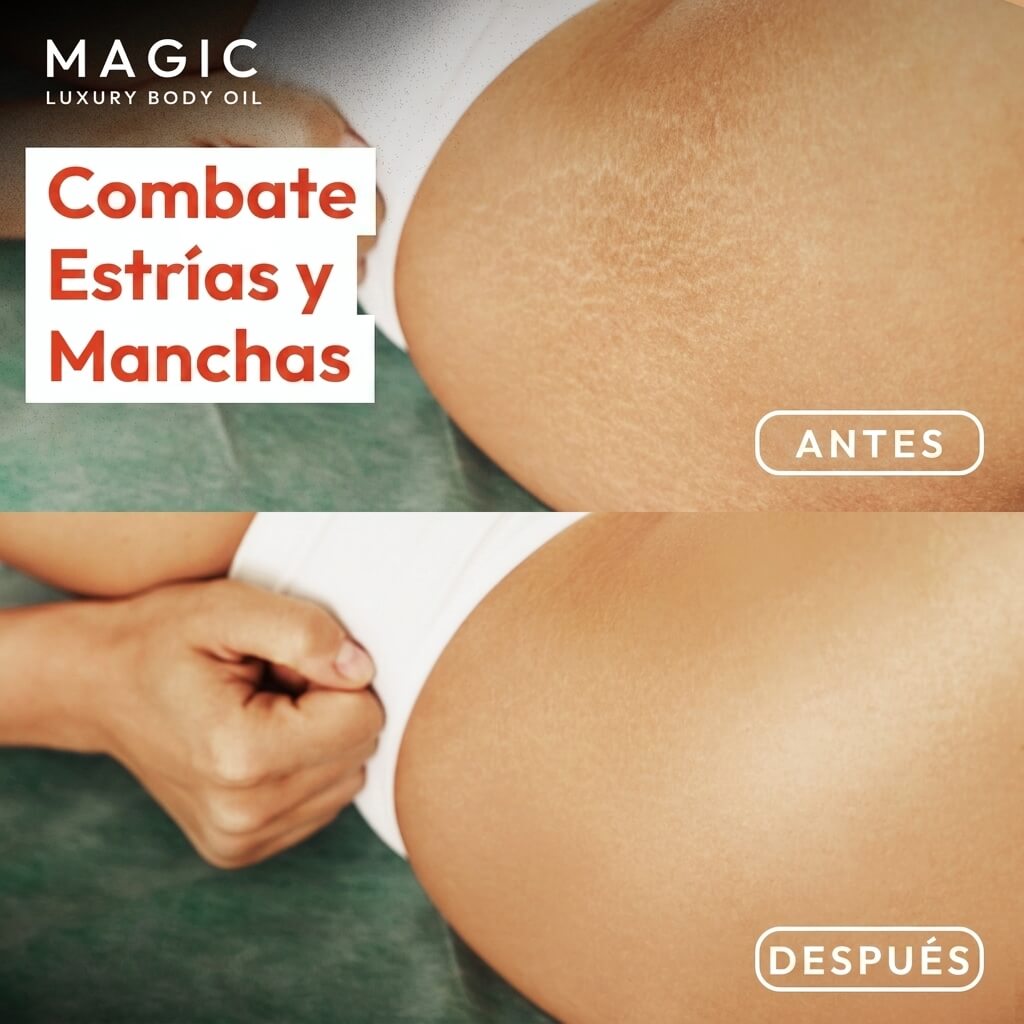 WEST MONTH Magic Luxury Body Oil - Cuidado e hidratación de la piel, suave y firme, cuidado diario, nutritivo e hidratante.